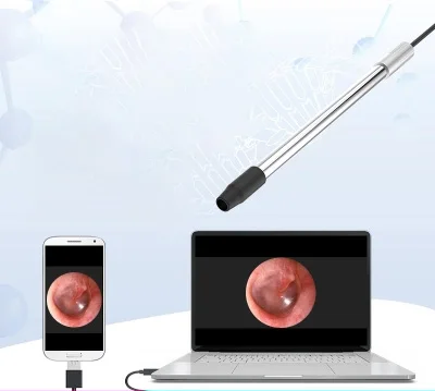 

Otolaryngology endoscope oralexam instrument cervix electronic colposcope mobile phone speculum high-definition camera