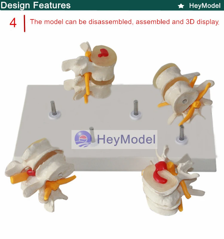 4 _