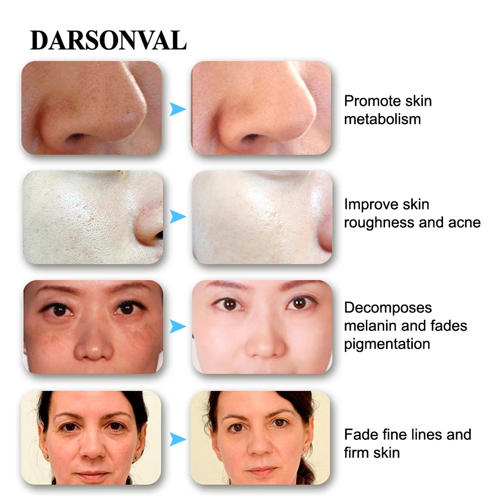 Darsonval for the face: reviews, photos 83 Darsonval for the face: reviews, photos 76