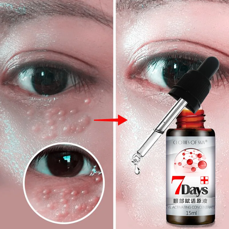 

Lighten Dark Circles In 7 Days Remove Eye Bags And Fat Particles Eye Serum Anti-Wrinkle Eye Skin Care Cream Anti Puffiness 15ml
