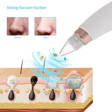 Прибор для вакуумной чистки лица чище, в черный горошек для маленьких девочек для глубокого очищения кожи лица чище электронный светодиодный Дисплей комедонов черных точек прыщей Удалить инструмент