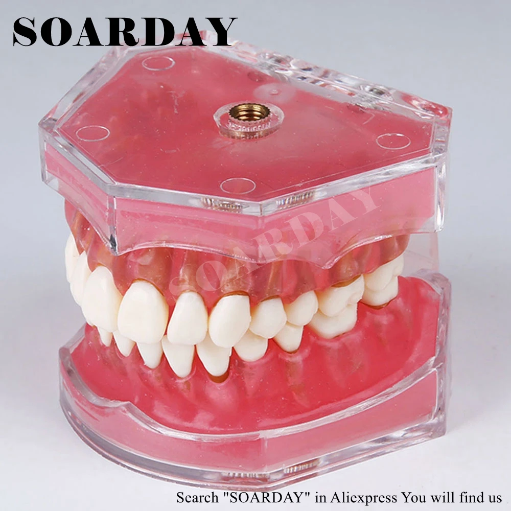 SOARDAY Стоматологическая стандартная модель зуб Съемные мягкие десны Стоматологическое обучение Стоматологическая коммуникационная модель