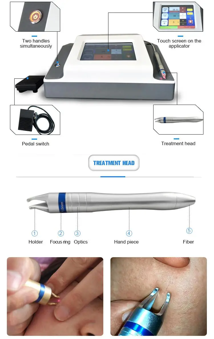 Эффективный лазер для удаления сосудов машина/лечение акне вены кровеносного сосуда машина красоты CE/DHL