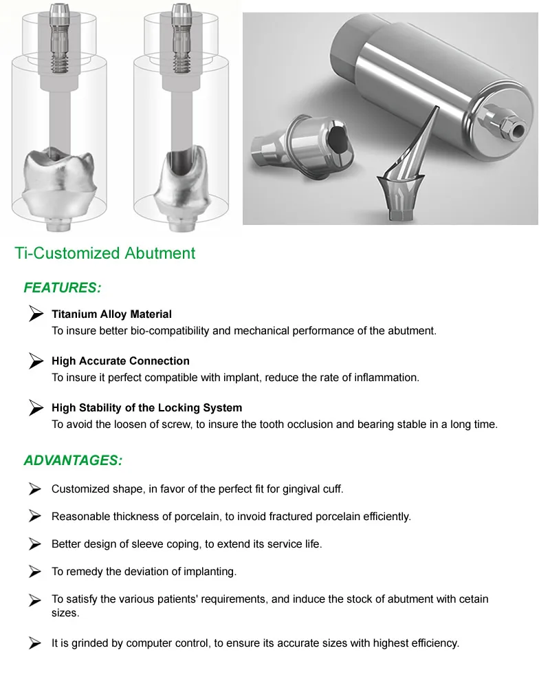 Pre-abutment details