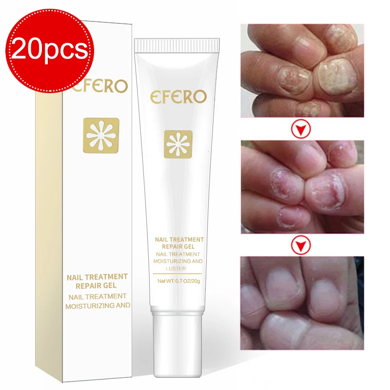 

20pcs Nail Treatment Feet Care Essence Anti Infection Onychomycosis Nails Repair Essence Whitening Toe Nail Fungus Removal Gel