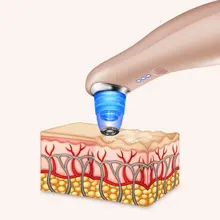 Инструмент для очистки черных точек электрическое всасывание черные точки очиститель инструмент для макияжа дома нового поколения мытье лица