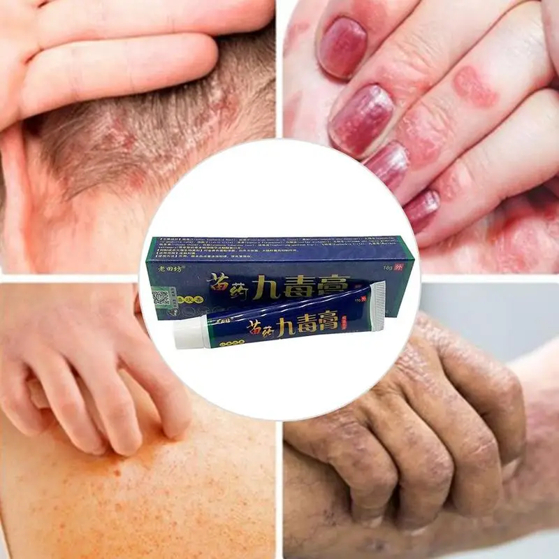 

Chinese Analgesic Cream Suitable For Rheumatoid Arthritis/ Joint Pain/ Back Pain Relief Analgesic Balm Ointment 18g