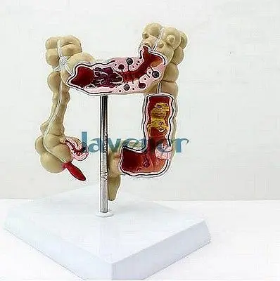 Human Anatomical Anatomy Colon Medical Pathology Model Digestive system | Канцтовары для офиса и дома
