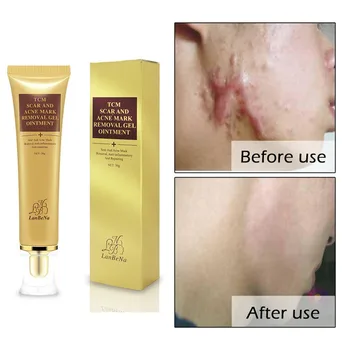 

Acne Scar Mark Removal Cream Anti-inflammatory Repairing Gel Skin Care Treatment