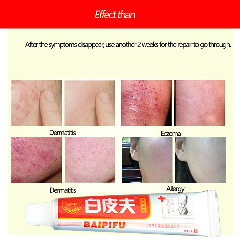 

Baipifu Original Body Cream good for skin health ease hot itchy pain Without Retail Box Hot Selling