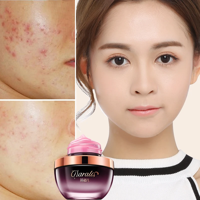 20g Snake Venom Extract Sleeping Facial Mask Acne Treatment Ageless