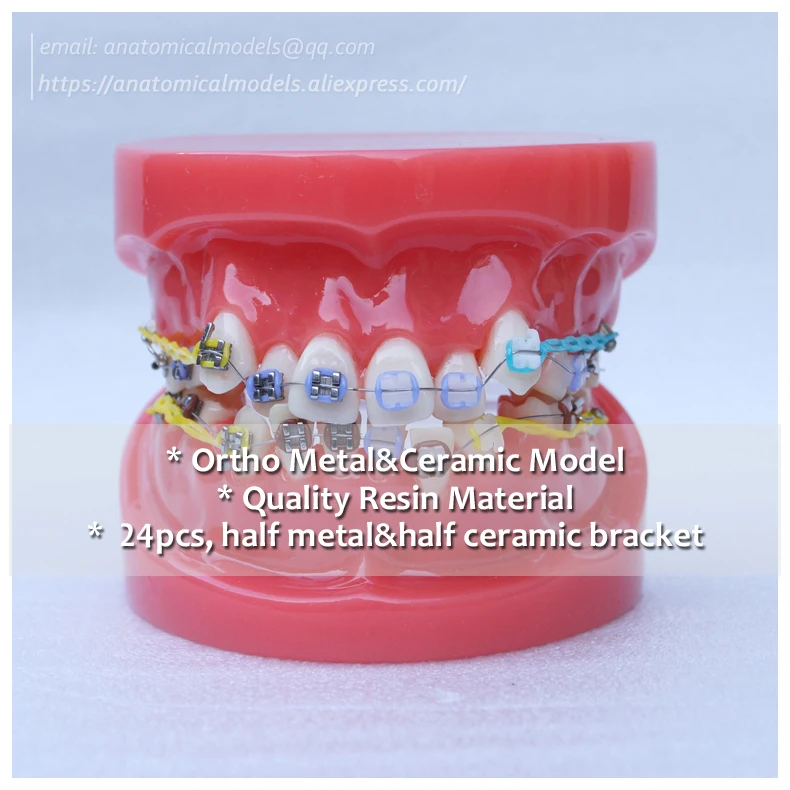 

No.13020, Ortho Metal&Ceramic Bracket Dental Mod, Dentist Gift Oral Dental Ortho Model, China Medical Anatomical Model