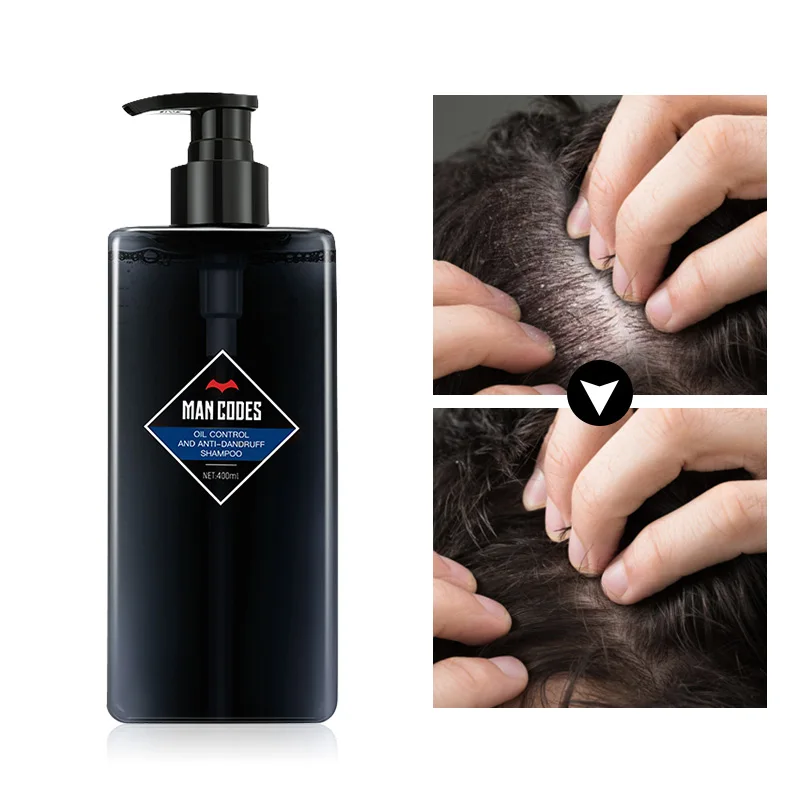 

MAN CODES 400ml Men Oil Control Cleaning Dandruff Shampoo Anti Hair Loss Shampoo Divide Mite Suppression Mite Anti-Itching Care