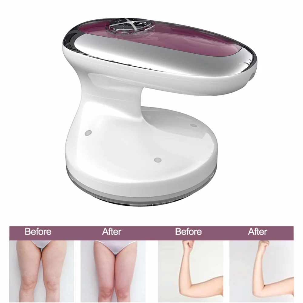 

RF Radio Frequency Face Body Slimming Machine Ultrasonic Light Therapy Anti Wrinkles Skin Tighten Anti Cellulite Beauty Massager