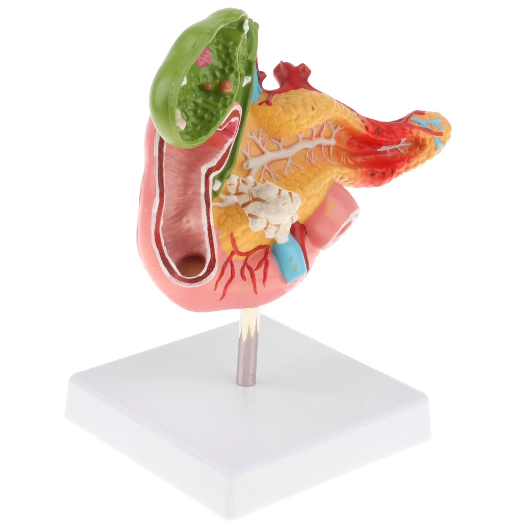 1:1 Human Pancreas Duodenum Gallbladder Pathological Anatomical Model Lab Supplies