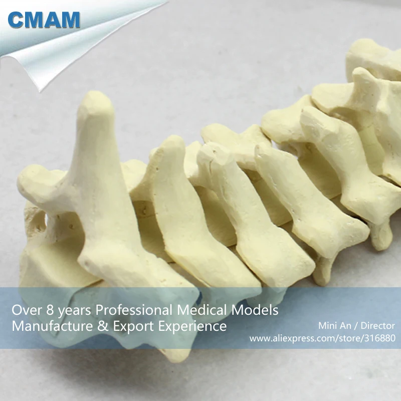 12312/C1-C7 шейного позвонка Кости Модель для тренировок, Медицинские Учебные анатомические модели