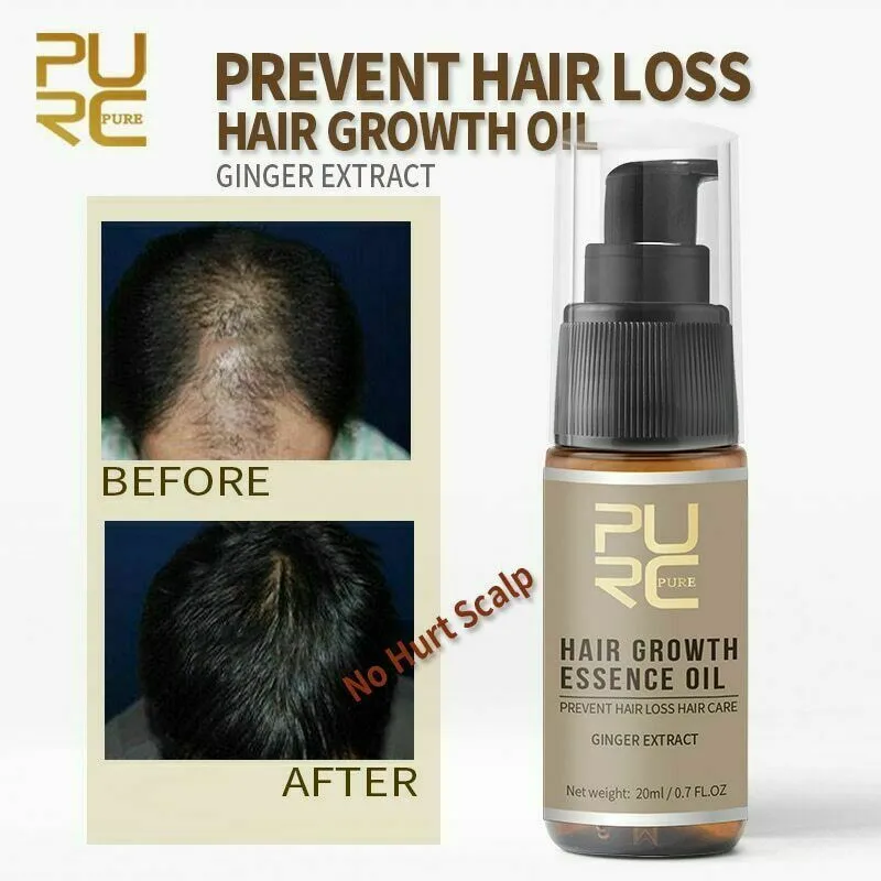 Hair Growth Products For Men Women Natural Oil Serum Loss Grow