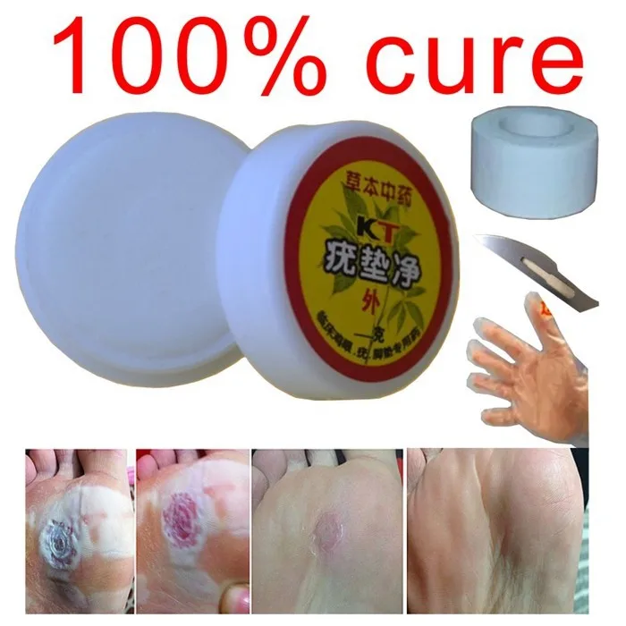 

Chinese Natural horniness Skin bumps Plantar wart Meat thorn Flat Toe Filamentous warts corns ointment wart removal