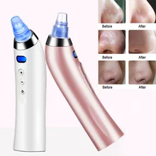 USB пополнение лицо очиститель акне Электрический для удаления угрей extractor для ухода за кожей лица машинка для очистки кожи для груза падения