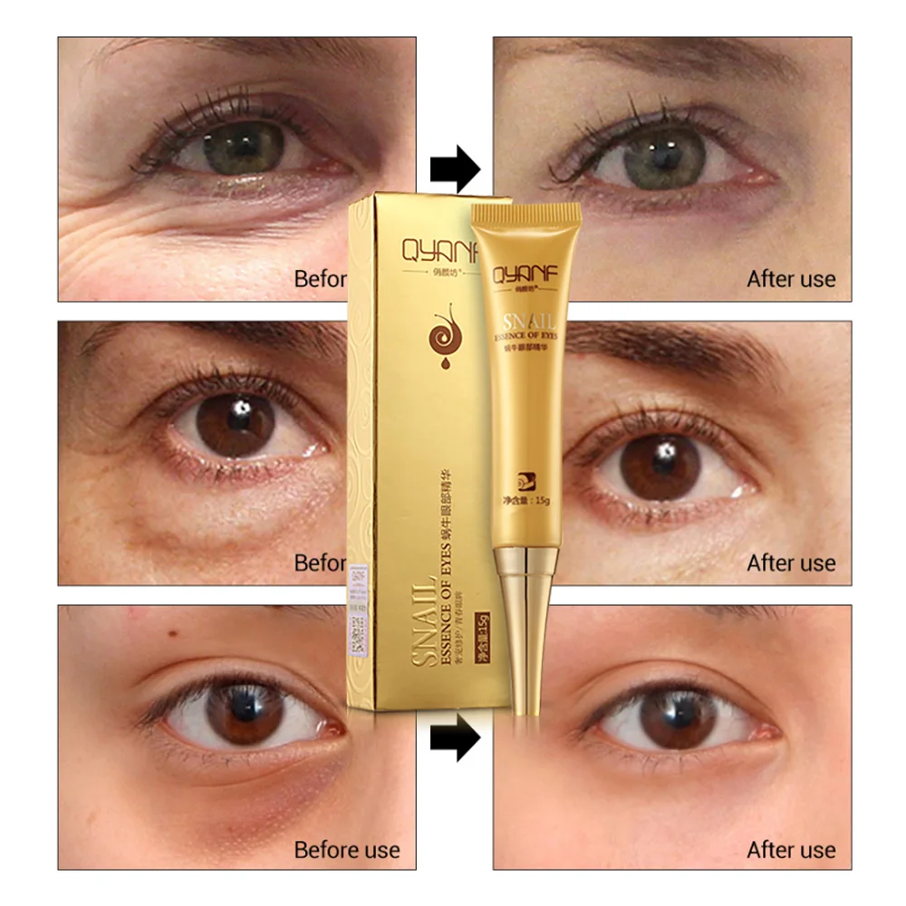 

QYF The Snail Eye Essence Beauty Skin Care Eye Serum Anti Aging Anti Wrinkle Remove Dark Circle Whitening