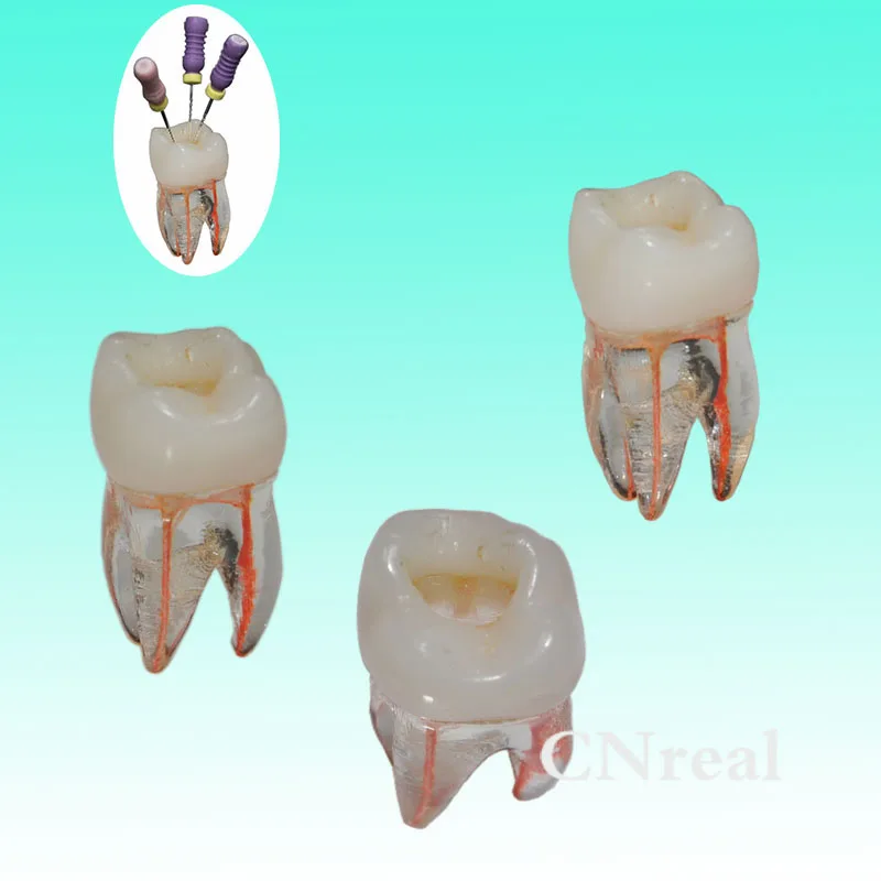 3 шт./лот зуб корневой канал зубы модель для RCT практики прозрачная смола с целлюлозной полости и окрашенный корневой канал