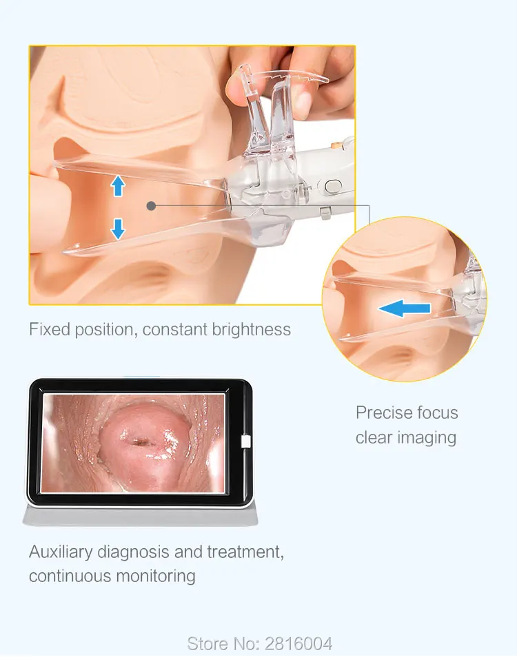 Портативный цифровой видео электронный мини кольпоскоп FA2 3000 000 пикселей с экраном дисплея Солнечный Медицинский мини-костюм SEYES