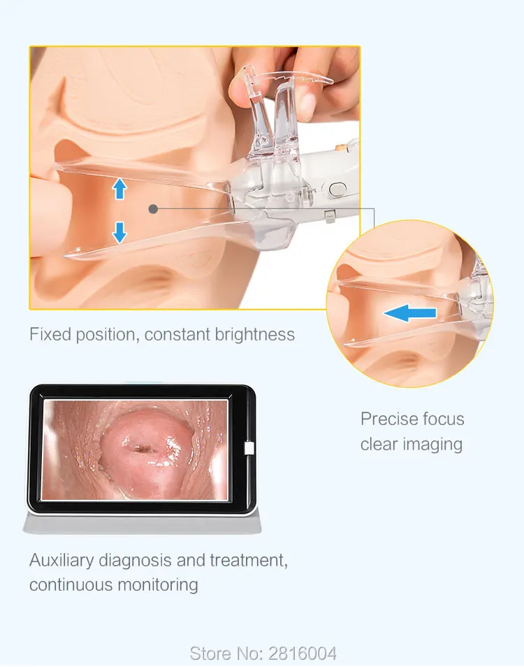 Pixels com Tela de Exibição Vídeo Digital Portátil Eletrônico Mini Colposcope Fa2 3000 000 Ensolarado Miniscope Médico Terno Seyes 9 Beleza e saúde
