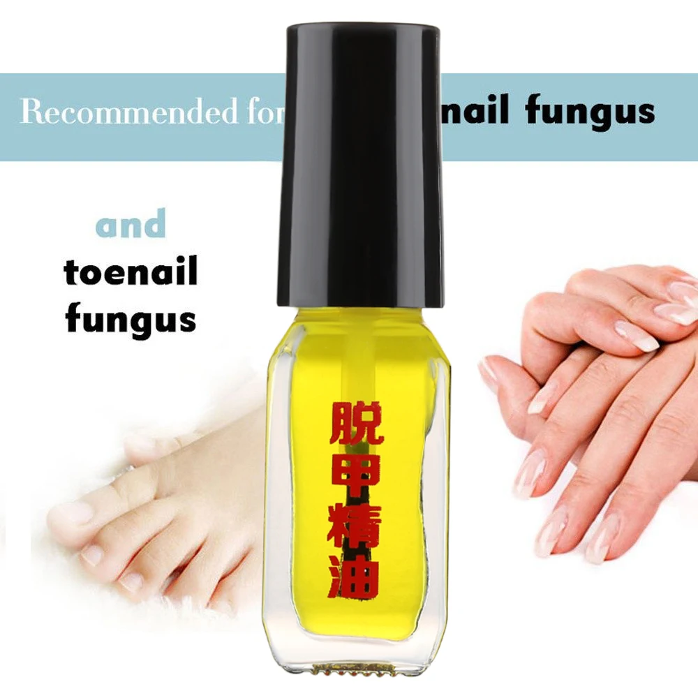 1 бутылочка 5 мл грибковая эссенция для удаления жидких грибковых ногтей яркий ремонт ногтей анти-инфекция Уход за ногами масло онихомикоза