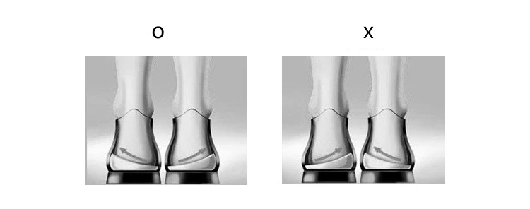 MQUPIN силиконовые O/X ноги коррекция ортопедии ортопедическая коррекция пятки площадку Половина ног вставки стельки корректор