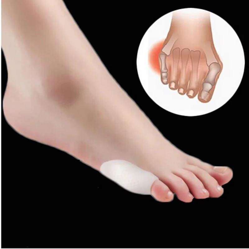 

1pair Toe Small Bone Foot Care Silicone Hallux Valgus Feet Braces Supports Pedicure Orthopedic Braces To Correct Toe J11