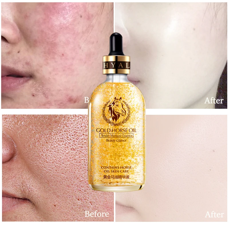 

ROREC 24K Gold Horse Oil Face serum Hyaluronic Acid Replenishment Moisturize Shrink Pore Brighten Nicotinamide Skin Care 100ml