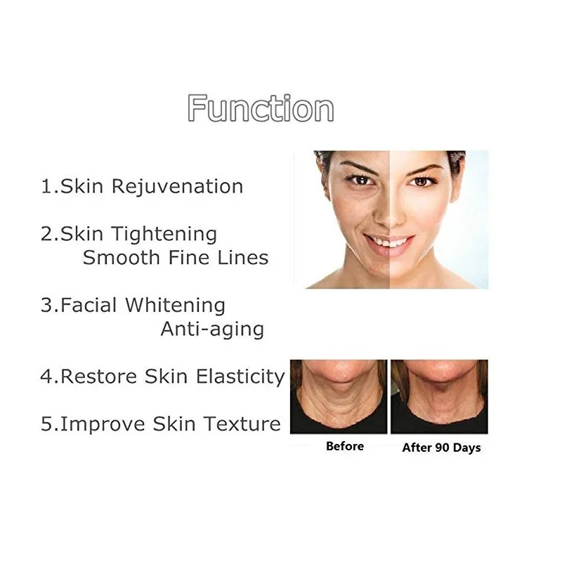 Günstige Radio Frequenz Fernen Infrarot Dot Matrix Thermage Gesichts Maschine für Anti aging Falten Entfernung Ernährung Führenden in Haut heben