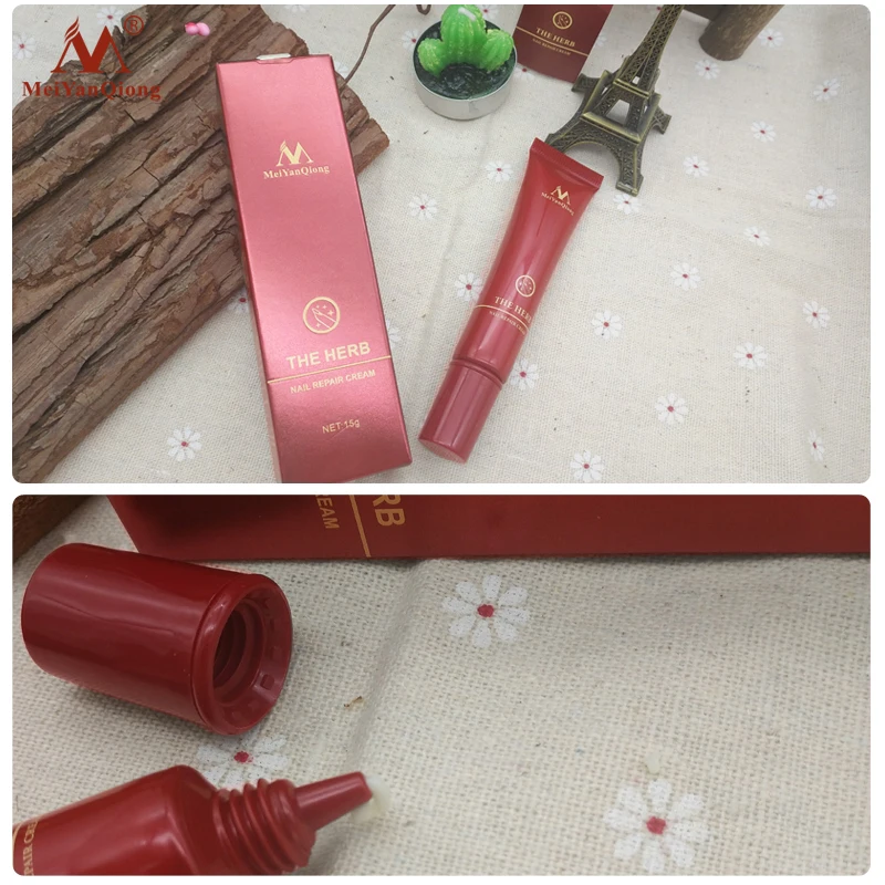 MeiYanQiong Herbal Nail Fungus Treatment Nail Care Tools Repair Skin Care Cream Remedy For Nail Foot Fungus Toe Cuticle Oil