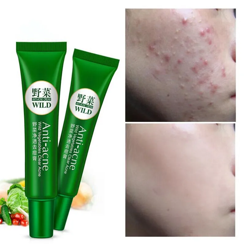 Wild Vegetables Face Acne Treatment Skin Care Acne Scars Cream Anti