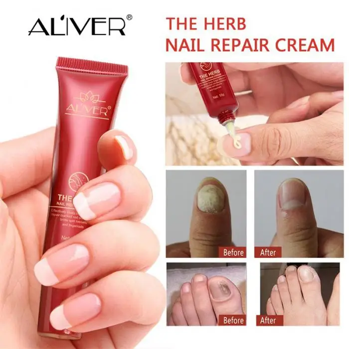 Nail Repair Cream Nourishing Herb Fingernail Care Treatment Striking Ointment 88