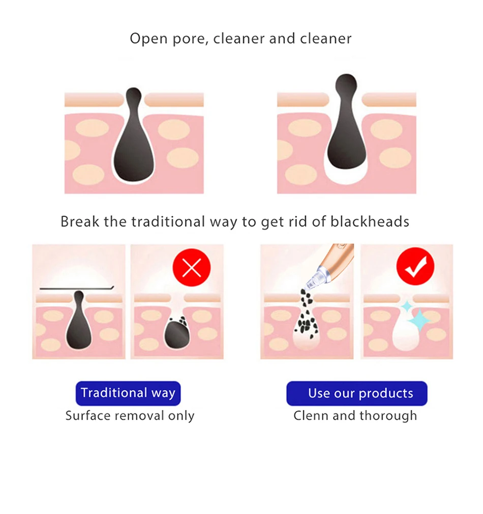 Electric Blackhead Remover (7)