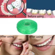 Стоматологический набор флоссов для зубов Уход за полостью грязи между зубьями удаление пятен и устранение плохого дыхания дропшиппинг 2m0713