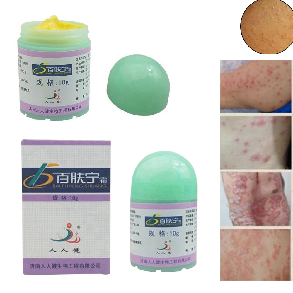 

10g Natural Chinese Medicine Herbal Anti Bacteria Cream Psoriasis Eczema Ointment Treatment High Quality Herbal Cream D248