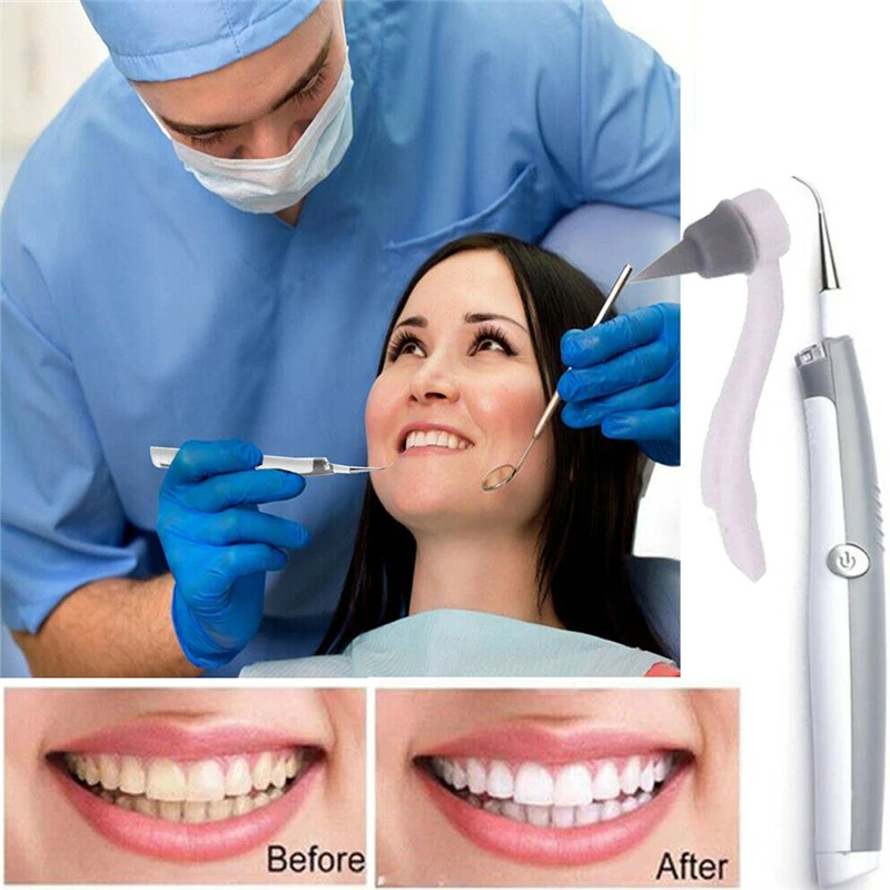 Eliminador de Dente Elétrica Sônico Lrrigator Oral Placa Dente Pedra Removedor Kit Ferramenta Dental Dentes Branqueamento Sistema Limpeza 15 Beleza e saúde
