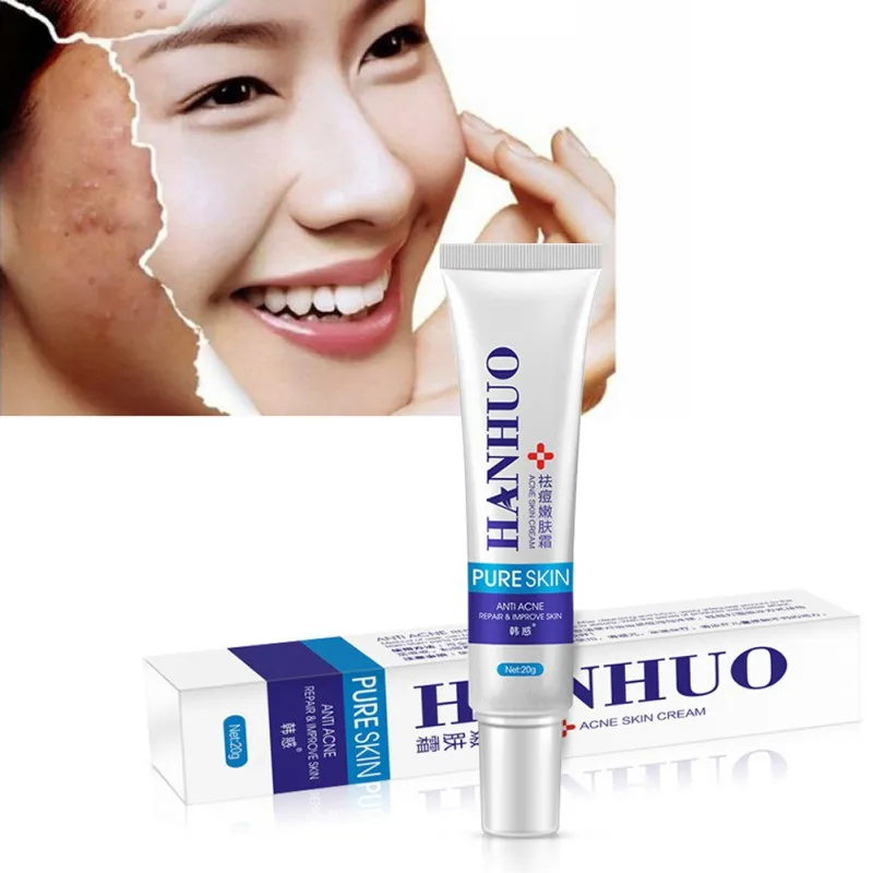 

New Face Beauty Cream Profession Acne Scar Remove Cream Face Care Whitening Moisturizing Face Cream Skin Care