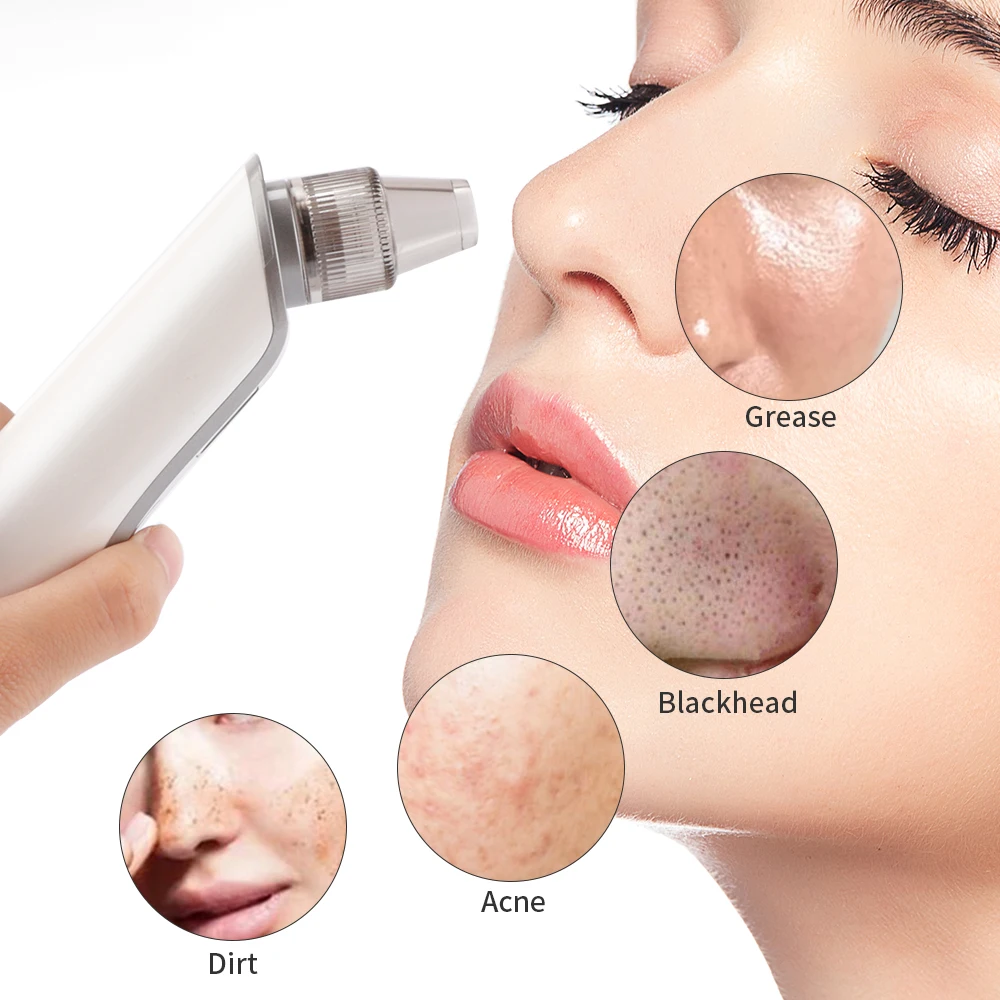 Removedor de Cravo Cuidados com a Pele Sucção a Vácuo Poros Vácuo Acne Espinha Remoção Rosto Poro Profunda Limpo 10 Removedor de cravo cuidados com a pele