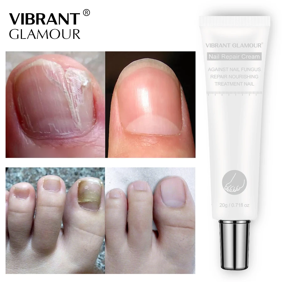 

20ML 1pc LANBENA Nail Care Nail Repair Cream Nail Fungus Treatment Onychomycosis Removal Anti Fungus Nail Toe Repair Cream TSLM1