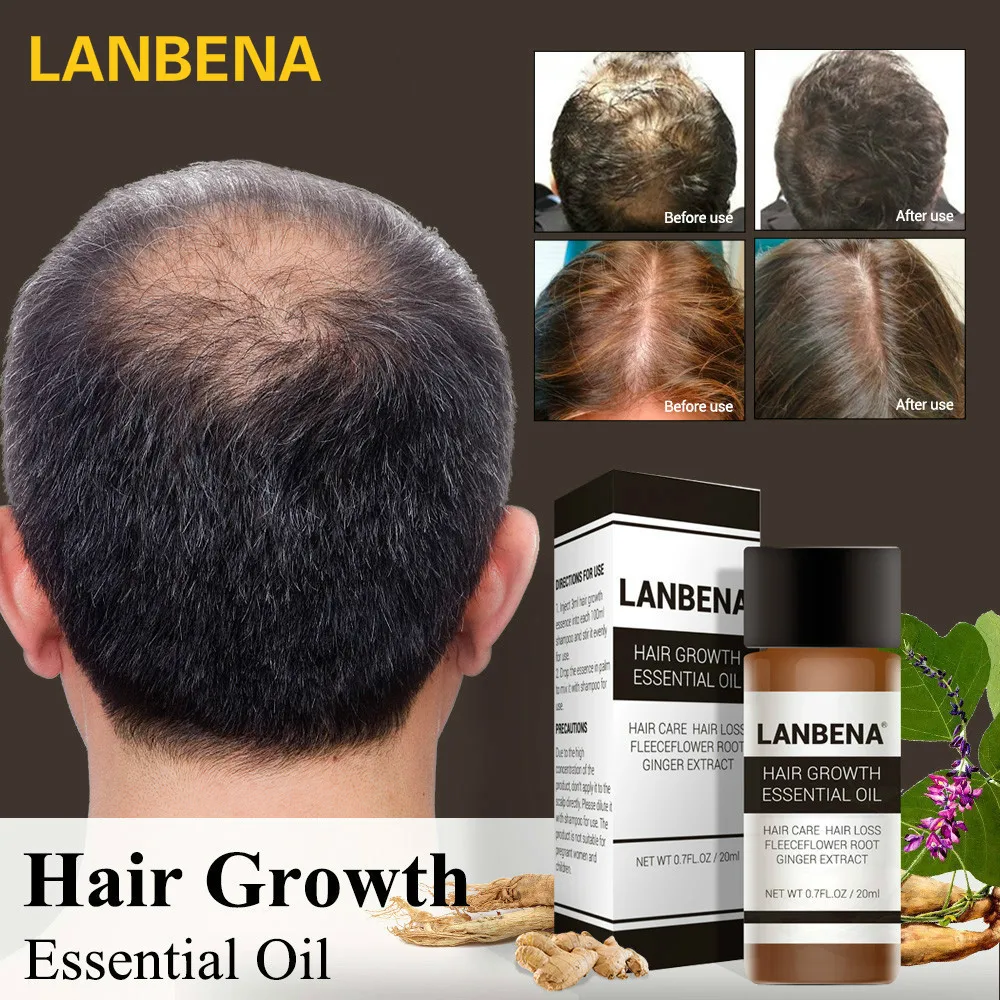 

LANBENA pure natural hair care products hair regrowth essential oil anti-hair loss increase rapidly thick hair growth essence