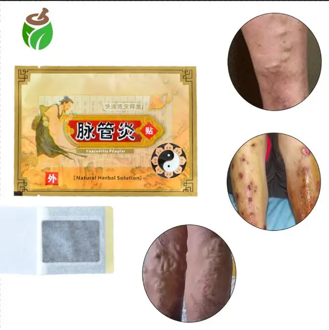 

10 Pieces varicose veins Vasculitis patches vasculitis spray compression stockings varicose spider leg veins