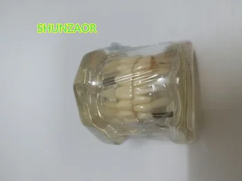 

1pcs Dental Implant Disease Teeth Model With Restoration Bridge Tooth Dentist For Medical Science Dental Disease Teaching Study