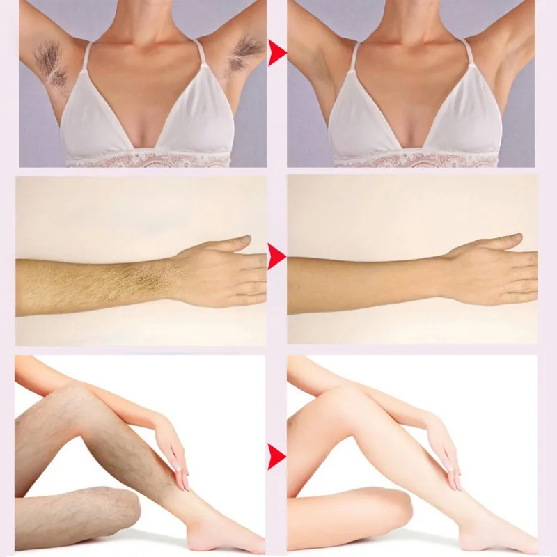 Манго депиляционный крем для тела безболезненный эффективный крем для удаления волос для мужчин и женщин Отбеливание рук ног подмышек