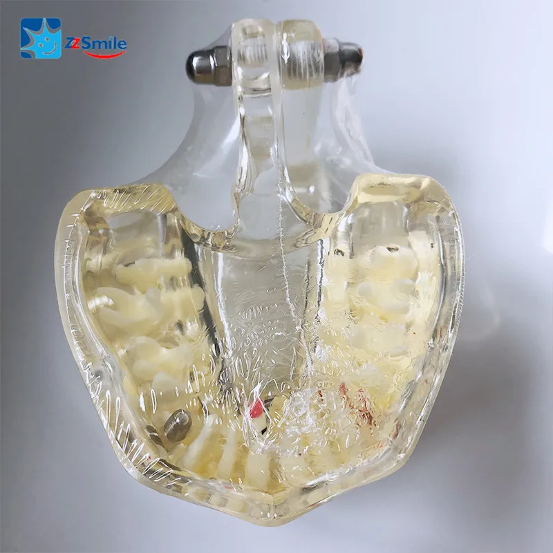 

M4001-2 Adult Model with Pathologies