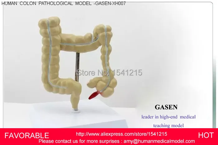 

DIGESTIVE SYSTEM ,MEDICAL OF COLON PATHOLOGICAL,HUMAN ORGAN MODEL COLORECTAL PATHOLOGICAL MODEL-GASEN-XH007