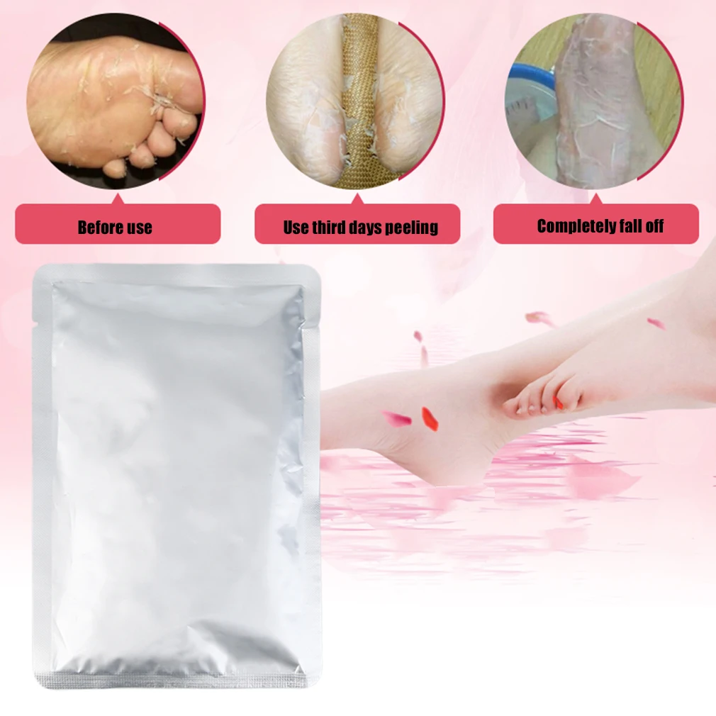 

Professional Butterfly Baby Foot Peeling Renewal Mask Cuticles Heel For Remove Dead Skin Excellent Feet Cleaning foot care