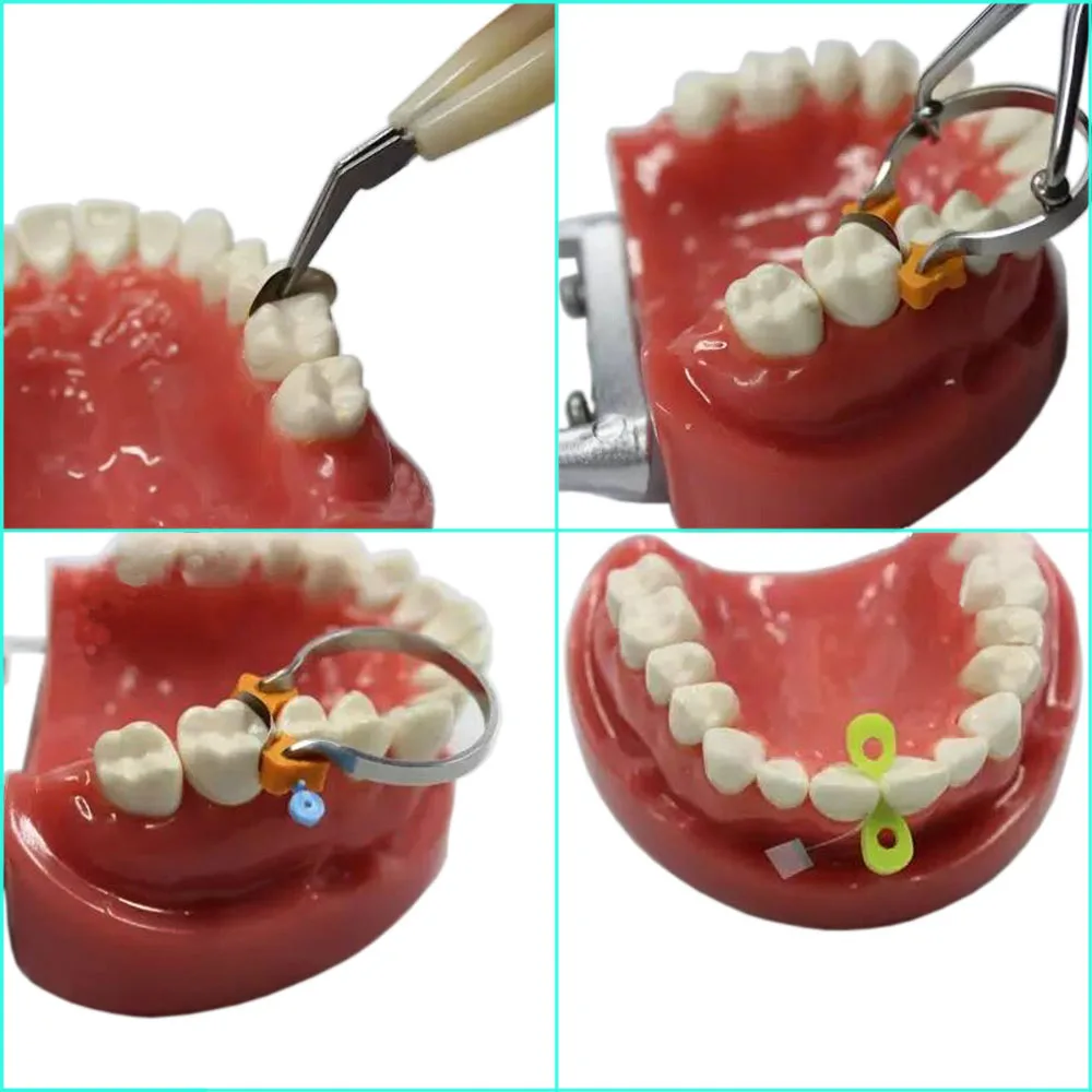 1 компл. Зубные секционные Контурные матрицы набор полимерных матричных полос клинья кольца плоскогубцы для работы по заполнению зубов